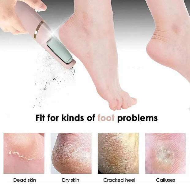 Pedicure Elétrica Profissional — Removedor de Calos e Pele Morta | Cuidado Completo Para Seus Pés!